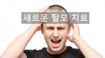 새로운 탈모 치료