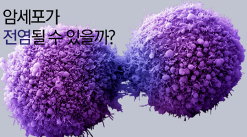 암이 전염될 수 있을까요?