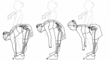 허리 통증 : 허벅지 스트레칭의 중요성에 대하여