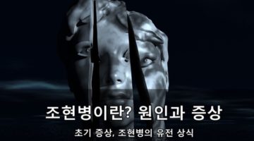 조현병이란? 원인과 초기 증상, 유전 상식