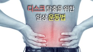 허리디스크와 재활 운동